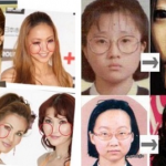 芸能人の整形前と整形後を比較した衝撃動画！ＮＨＫひよっこに出演中のあの女優も実は・・！？【閲覧注意】